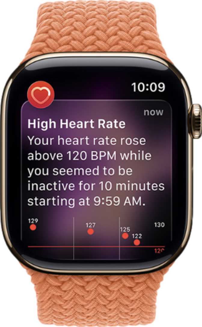 Apple Watch Series 11